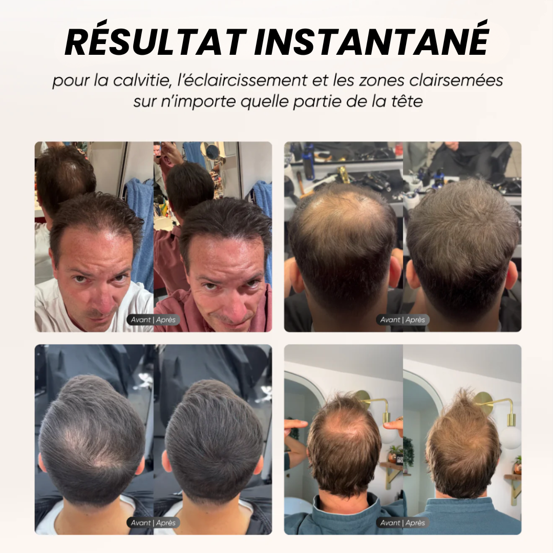 HairRich™ – La poudre qui masque instantanément vos zones dégarnies !