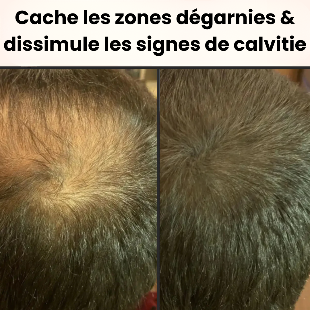 HairRich™ – La poudre capillaire naturelle qui redonne de la densité en 10 secondes
