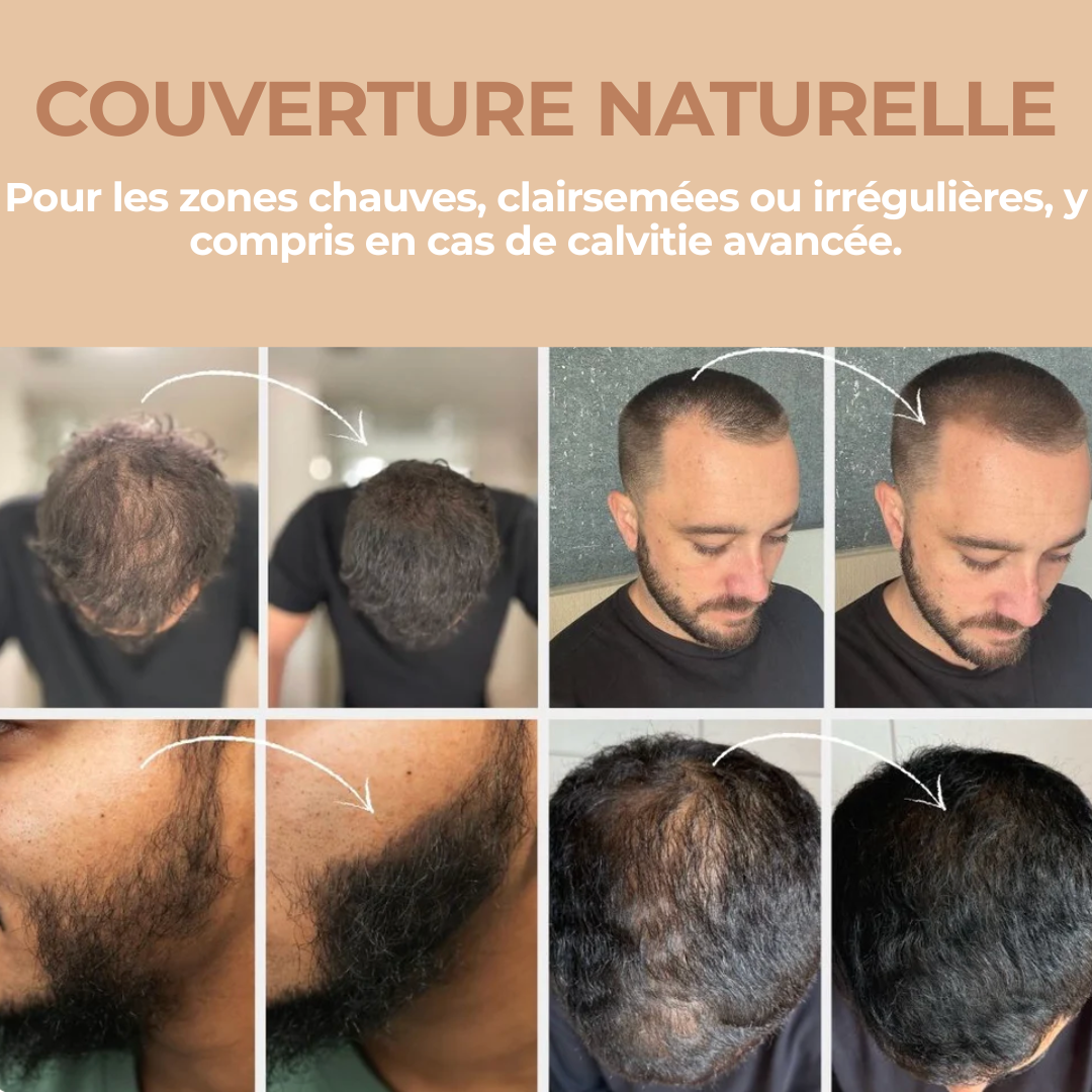 HairRich™ – La poudre capillaire naturelle qui redonne de la densité en 10 secondes